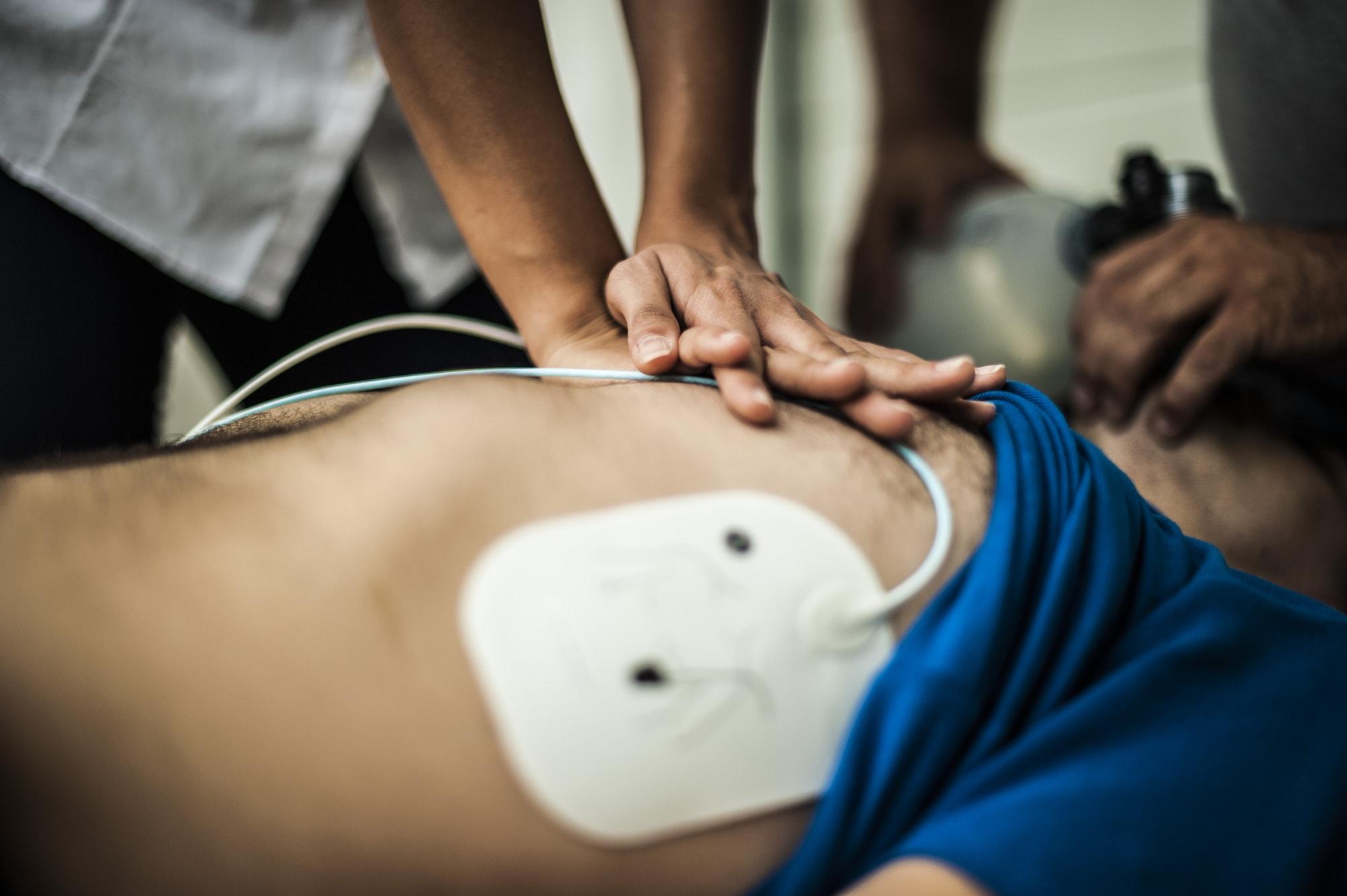 Zoll AED Plus: Saving Lives One Shock at a Time